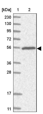 TRIM38 Antibody in Western Blot (WB)