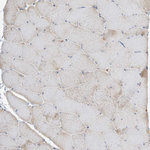 KYNU Antibody in Immunohistochemistry (Paraffin) (IHC (P))