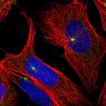 cGAS Polyclonal Antibody