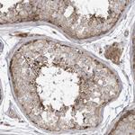 cGAS Antibody in Immunohistochemistry (Paraffin) (IHC (P))