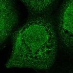 ZMYM2 Polyclonal Antibody