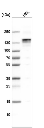 LATS1 Antibody in Western Blot (WB)