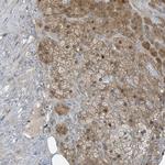 PARVG Polyclonal Antibody