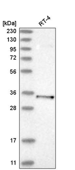 PARVG Antibody in Western Blot (WB)