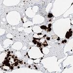 Pleckstrin Antibody in Immunohistochemistry (Paraffin) (IHC (P))