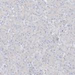 Pleckstrin Polyclonal Antibody