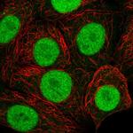 MORF4L2 Antibody in Immunocytochemistry (ICC/IF)