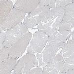 ZC3H12A Antibody in Immunohistochemistry (Paraffin) (IHC (P))