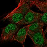 TRSPAP1 Polyclonal Antibody