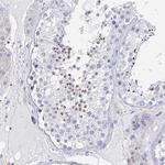CD30 Antibody in Immunohistochemistry (Paraffin) (IHC (P))