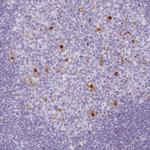 CD30 Antibody in Immunohistochemistry (Paraffin) (IHC (P))