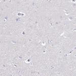 CD37 Antibody in Immunohistochemistry (Paraffin) (IHC (P))