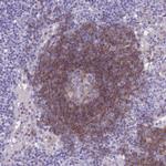 CD37 Antibody in Immunohistochemistry (Paraffin) (IHC (P))