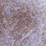 CD37 Antibody in Immunohistochemistry (Paraffin) (IHC (P))