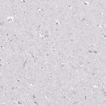 CD37 Antibody in Immunohistochemistry (Paraffin) (IHC (P))