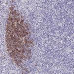 CD37 Antibody in Immunohistochemistry (Paraffin) (IHC (P))