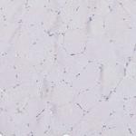 CD37 Antibody in Immunohistochemistry (Paraffin) (IHC (P))