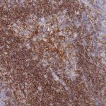 CD37 Antibody in Immunohistochemistry (Paraffin) (IHC (P))