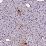 PPY Polyclonal Antibody