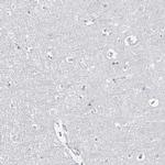 DOG-1 Antibody in Immunohistochemistry (Paraffin) (IHC (P))