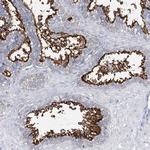 DOG-1 Antibody in Immunohistochemistry (Paraffin) (IHC (P))