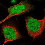 DDX1 Polyclonal Antibody