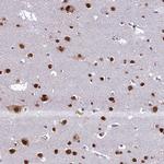 DDX1 Antibody in Immunohistochemistry (Paraffin) (IHC (P))