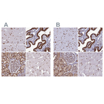DDX1 Antibody in Immunohistochemistry (Paraffin) (IHC (P))