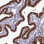 DDX1 Antibody in Immunohistochemistry (Paraffin) (IHC (P))