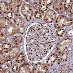 DDX1 Antibody in Immunohistochemistry (Paraffin) (IHC (P))