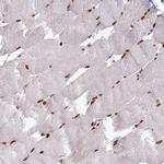 DDX1 Antibody in Immunohistochemistry (Paraffin) (IHC (P))