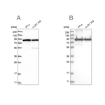 DDX1 Antibody in Western Blot (WB)