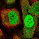 DDX1 Polyclonal Antibody