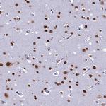 DDX1 Antibody in Immunohistochemistry (Paraffin) (IHC (P))