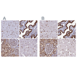 DDX1 Antibody in Immunohistochemistry (Paraffin) (IHC (P))