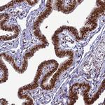 DDX1 Antibody in Immunohistochemistry (Paraffin) (IHC (P))