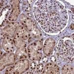 DDX1 Antibody in Immunohistochemistry (Paraffin) (IHC (P))