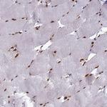 DDX1 Antibody in Immunohistochemistry (Paraffin) (IHC (P))