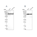 DDX1 Antibody in Western Blot (WB)