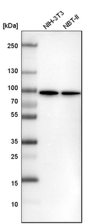 DDX1 Antibody in Western Blot (WB)