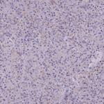 beta Adducin Polyclonal Antibody