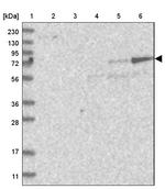 beta Adducin Antibody in Western Blot (WB)