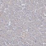 PRC1 Antibody in Immunohistochemistry (Paraffin) (IHC (P))