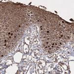 PRC1 Antibody in Immunohistochemistry (Paraffin) (IHC (P))