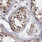 PRC1 Antibody in Immunohistochemistry (Paraffin) (IHC (P))