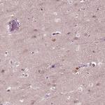 CRMP5 Antibody in Immunohistochemistry (Paraffin) (IHC (P))