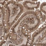 ATAD2B Antibody in Immunohistochemistry (Paraffin) (IHC (P))