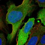 UBE2C Polyclonal Antibody