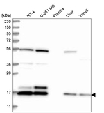 UBE2C Antibody in Western Blot (WB)