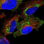 PNPase Polyclonal Antibody